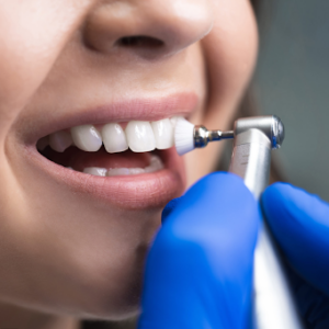 Comprehensive Care: Dental Cleanings and All-on-Four Implants Explained